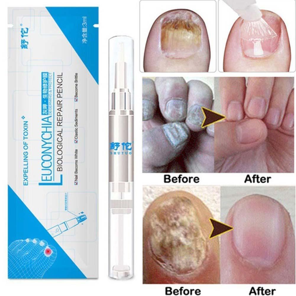 7-DAY Fungal Nail Repair Pen