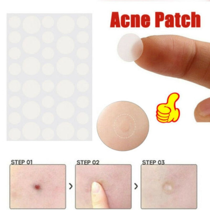 SkinTag Organic RemoverPatch (35PCS SET)