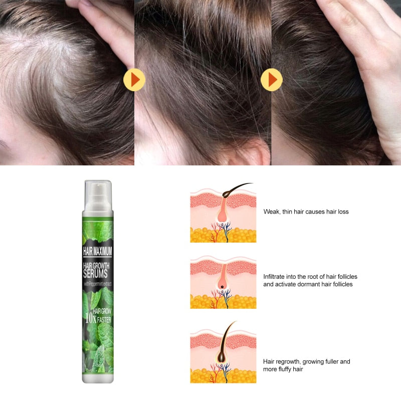 Hair-Growth Essence Spray